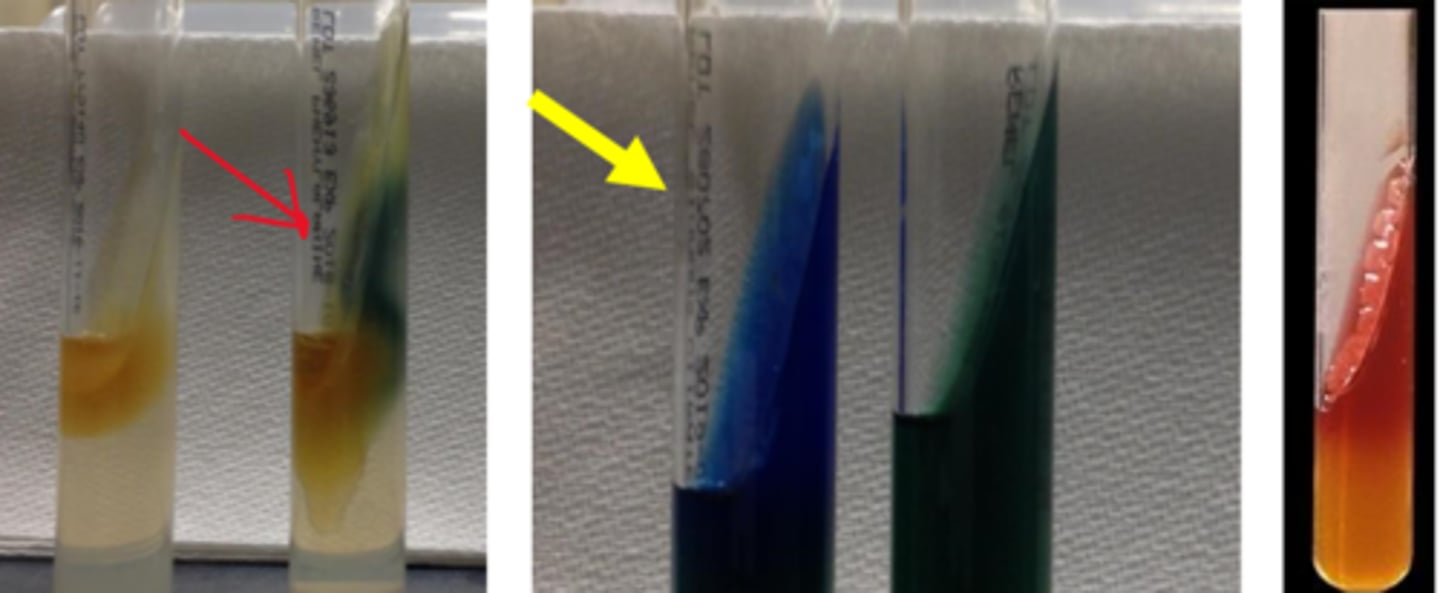 <p>No lactose fermentation</p><p>Phenylalanine-positive</p><p>Citrate positive</p><p>H2S negative</p>