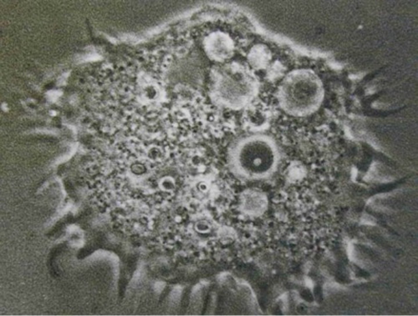 <p>A genus of amoeba</p><p>One of the most common single celled eukaryotes in soil and frequently in fresh water.</p><p>Has two forms - metabolically active trophozoite.</p><p>Dormant - stress resistant cyst.</p><p>Causes keratitis and granulomatous amoebic encephalitis.</p>