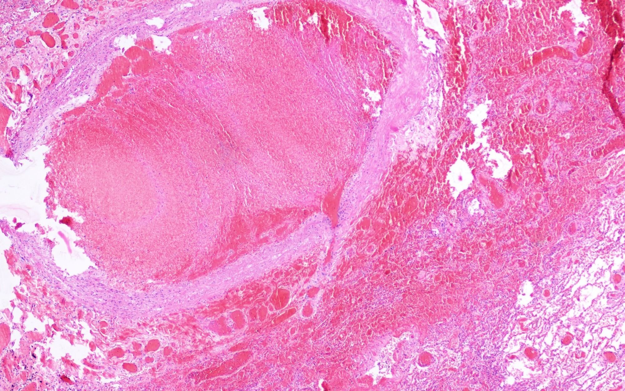 term image