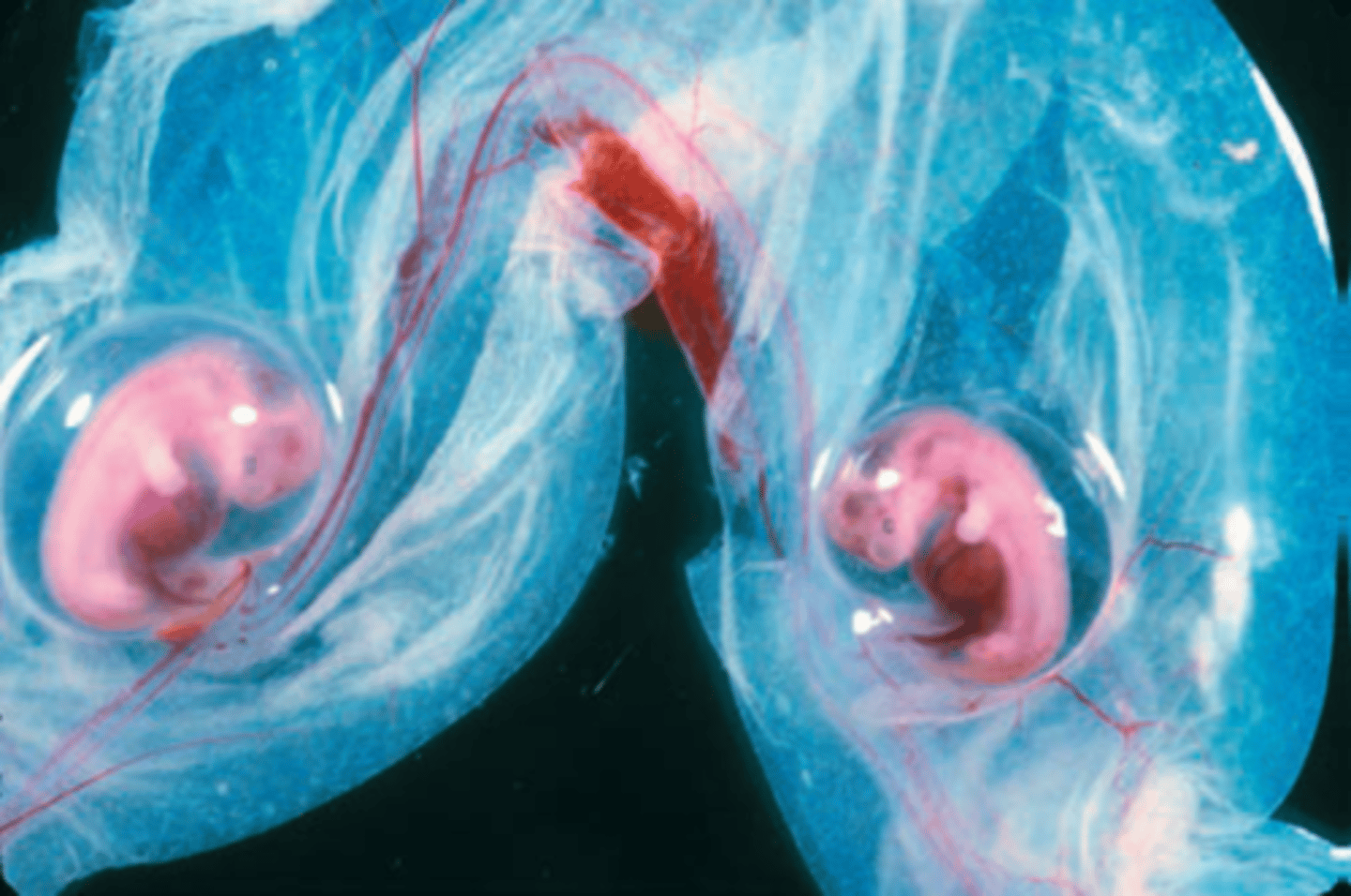 <p>Organism whose cells are derived from 2 or more zygotes</p>