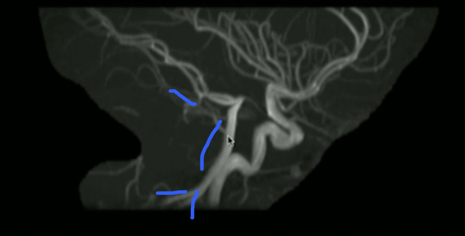 <p>Label these 3 vessels (inferior to superior)</p>