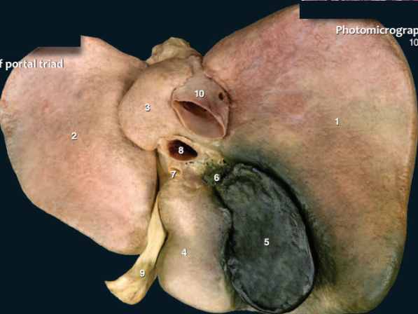 <ul><li><p>Gan</p></li></ul><p>Số 8: TM cửa (hepatic portal vein)</p><p>Số 10: TM chủ dưới (inferior vena cava)</p>