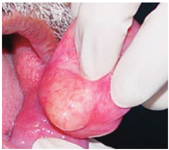 <p>What lesion is this?</p>