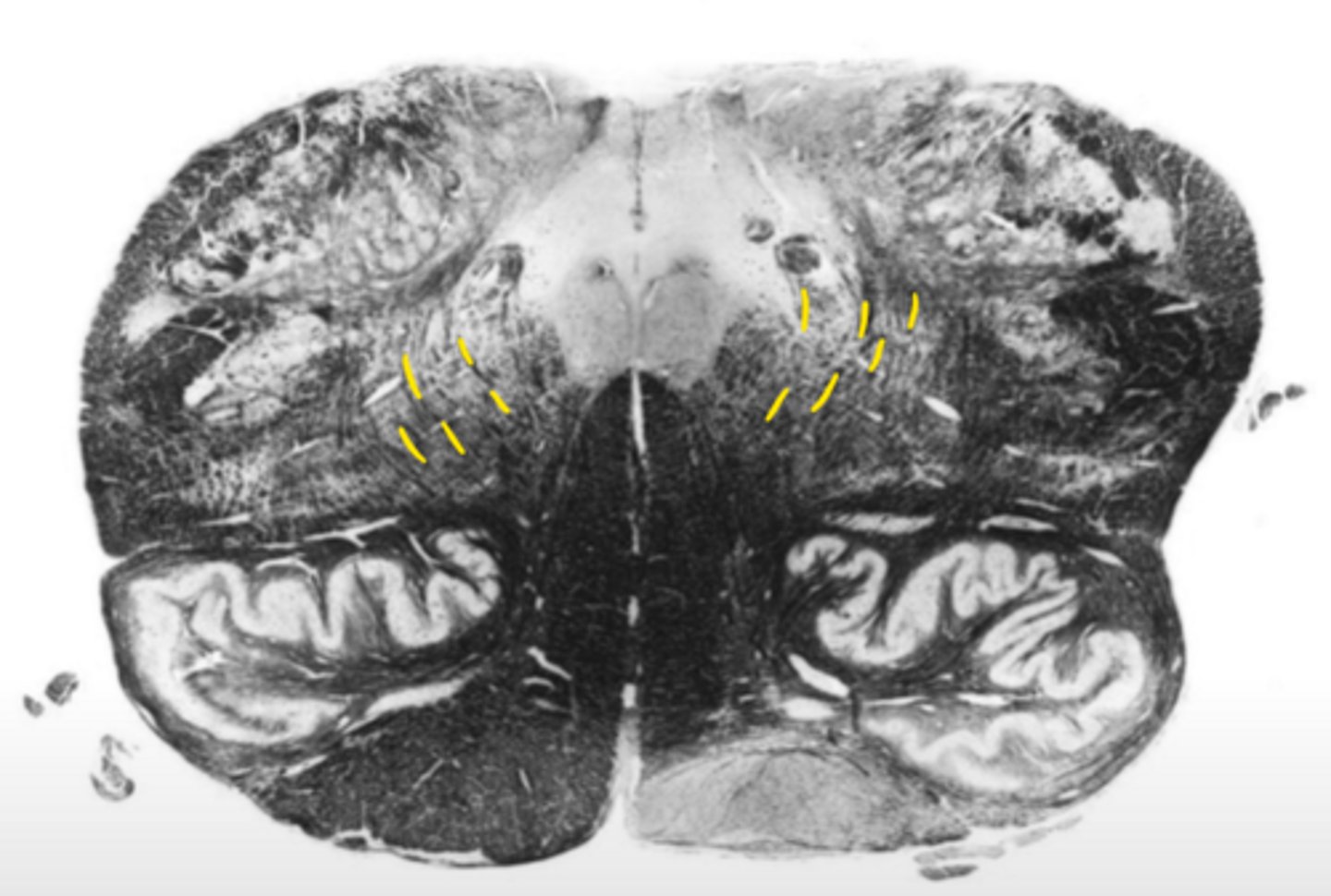 <p>ID the fibers</p>