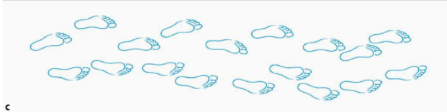 <p>Describe the walk (and its etiology)</p>