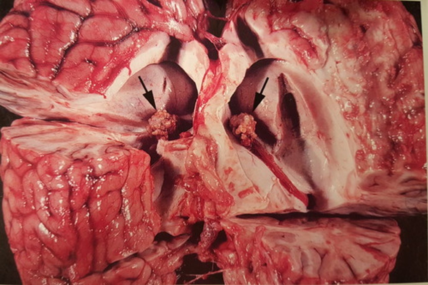 <p>Hjerne fra hest. Patoanatomisk diagnose?</p>