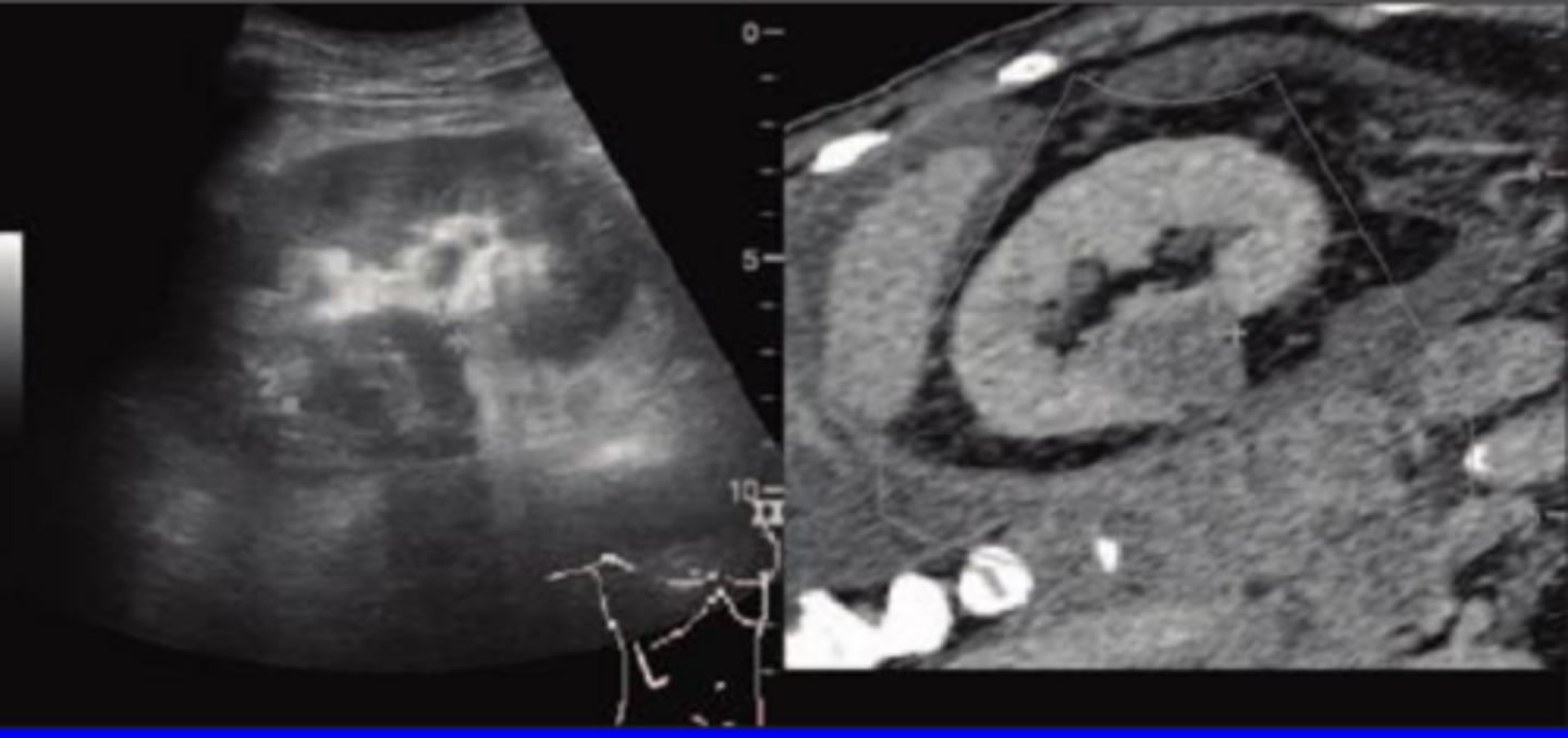 <p>Overlaying/co-registration of images from the same or different imaging modalities</p><p>Computer software matches ultrasound imaging with CT, MRI, or PET/CT</p>