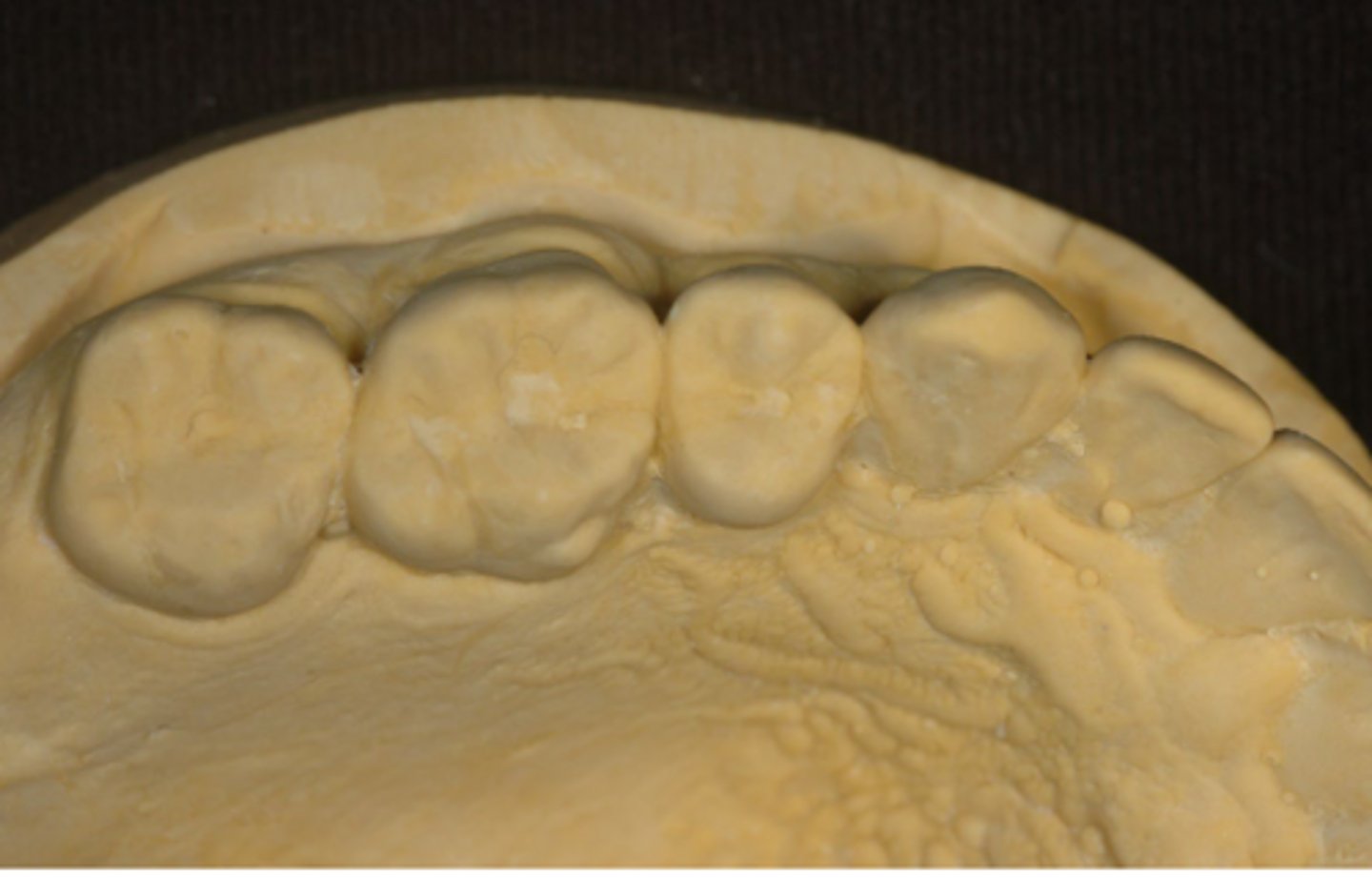 <p>What type of stone was this from?</p>