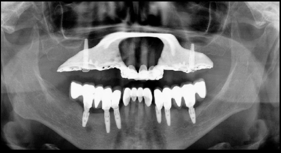 <p>What should you have asked this patient prior to exposing?</p>