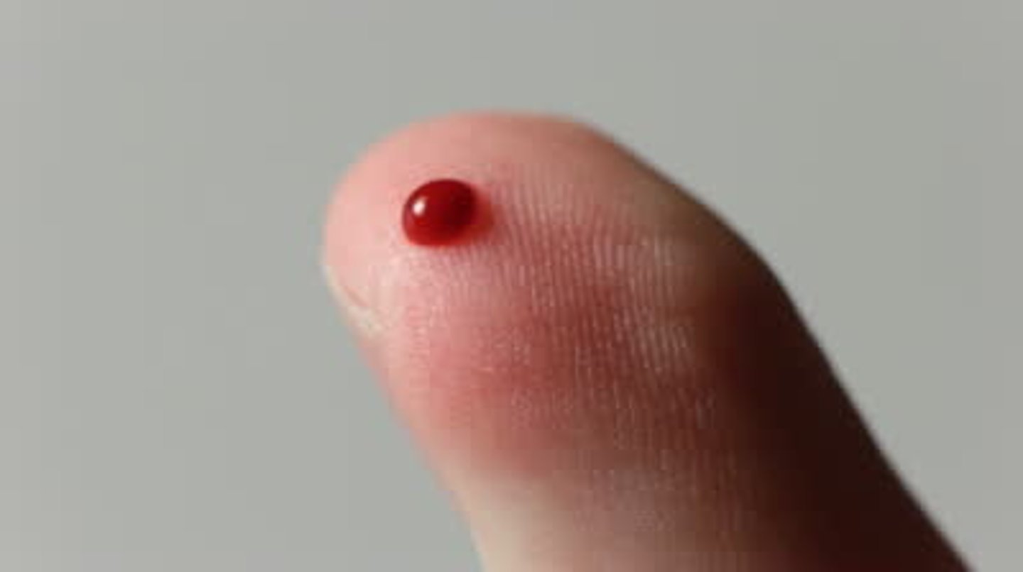 <p>blood / Máu (Đực)</p>