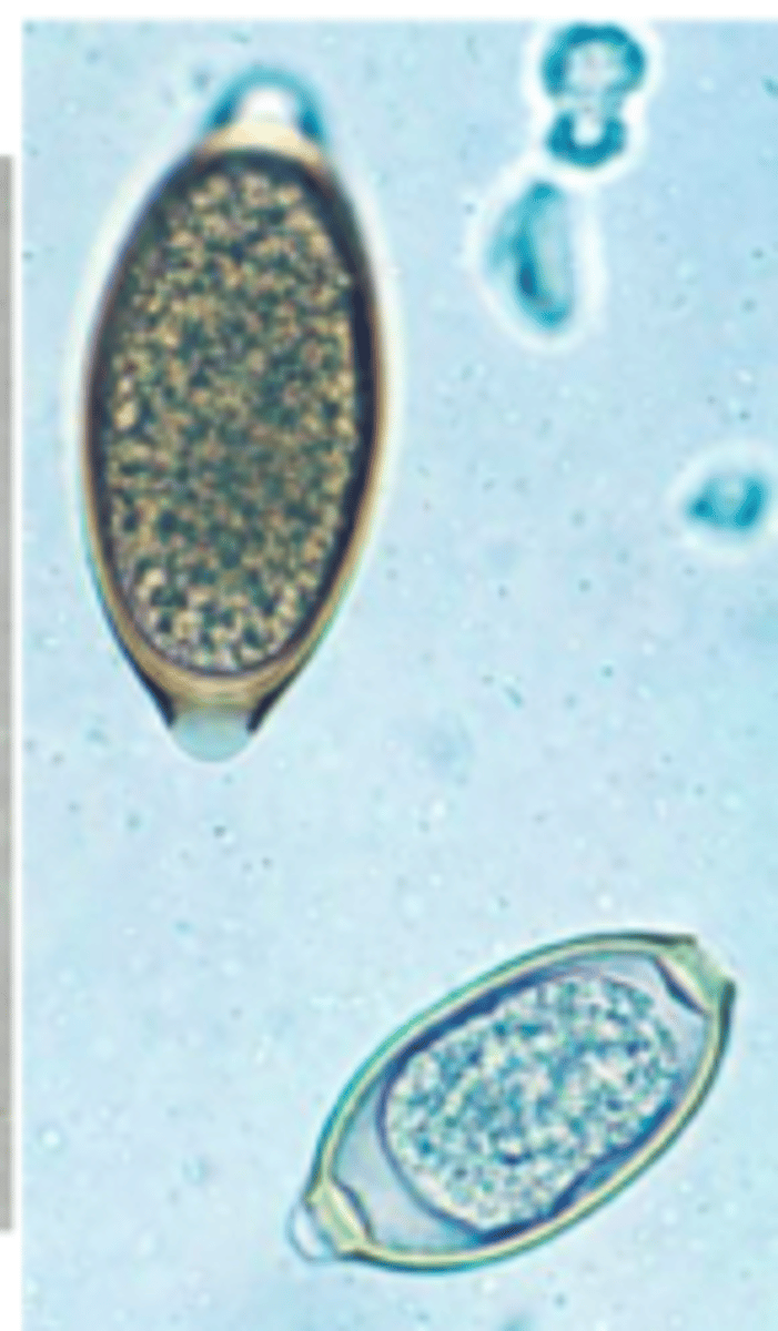 <p>Top Left is Trichuris</p><p>Bottom right is Capillaria</p>