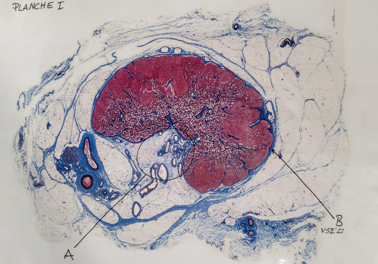 Capsula lymphonodus