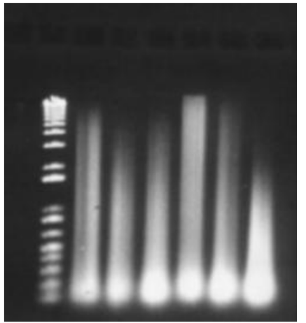 <p><span><u>Star activity</u> = When RE cuts the DNA too many times, results in extra bands (RE GONE NUTS) </span></p><ul><li><p class="Paragraph SCXW258747738 BCX0" style="text-align: left;"><span>Heat inactivation required to stop RE from over cutting </span></p></li></ul><ul><li><p class="Paragraph SCXW258747738 BCX0" style="text-align: left;"><span>On a gel, there will not be a DNA smear visible at the top of the gel because DNA is degraded </span></p></li></ul><p></p>