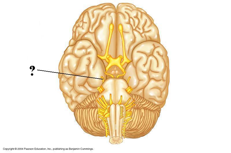 <p><span><span>Identify the indicated cranial nerve</span></span></p>