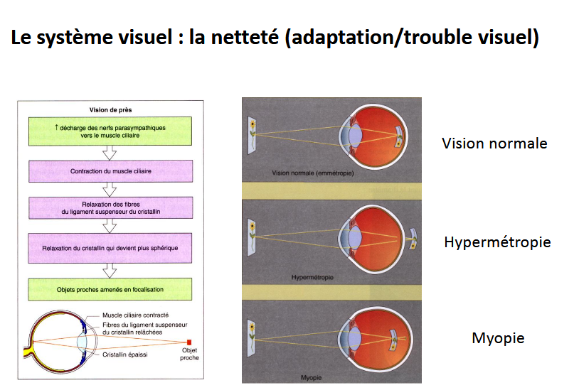 <p>image avant la rétine, voit bien de proche mais pas de loin</p>
