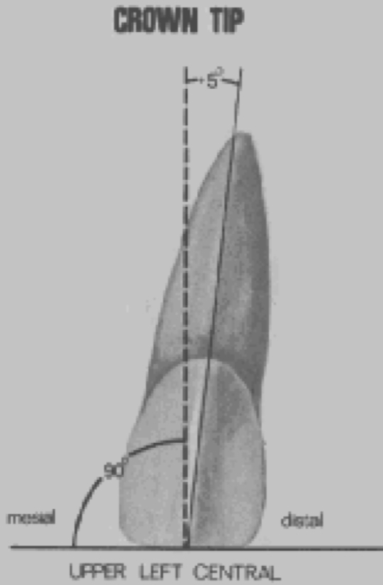 <p><strong>Crown angulation (tip)</strong></p><p>Degree of crown tip</p>