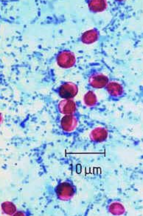 <p>what microbe</p><p>what stain</p>