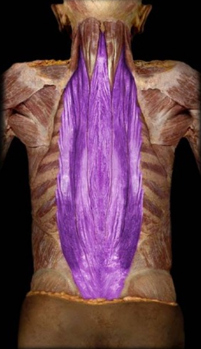 <p>what muscle is this?</p>
