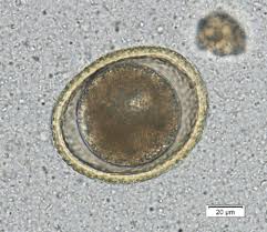 <p><em>Toxocara canis</em></p><p></p><p>Round, non-larvated eggs</p>