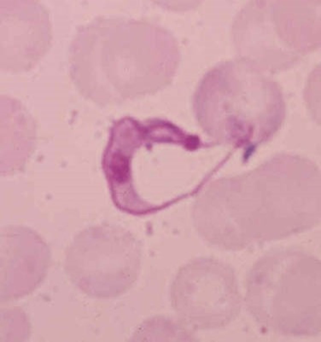 <p>This was found on a blood smear from a dog in a kennel in Louisiana where many young dogs are dying. Others are anemic and febrile. What is it?</p>