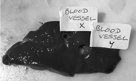 <p></p><p>A student dissected an organ from a mammal to observe blood vessels. He dissected a slice of the organ and identified two blood vessels. Figure 1 shows a photograph of his dissection.</p><p>Describe <strong>two</strong> precautions the student should take when clearing away after the dissection. (2) </p>