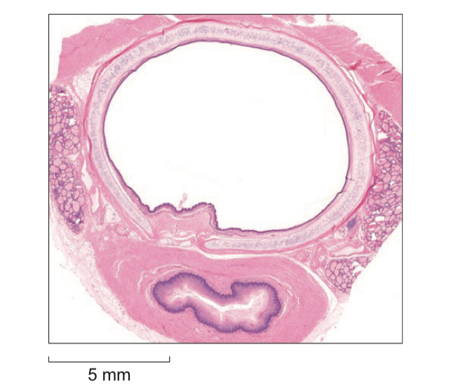 <p>Explain how a feature visible in photograph ensures the trachea can function effectively during inspiration </p>