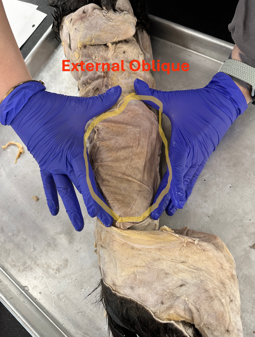 <p>External Oblique (Abdominal Muscles)</p>