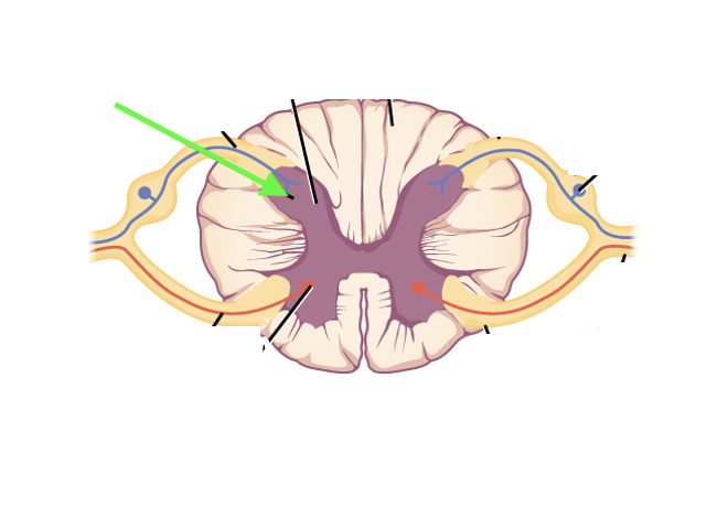 <p>what spinal cord area is this?</p>