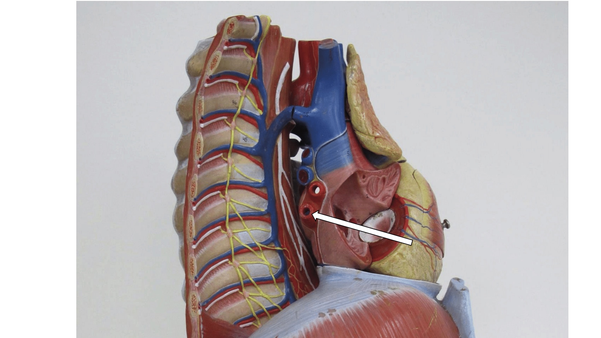 <p><span>bloedvat (</span>lateraal zicht mediastinum)</p>