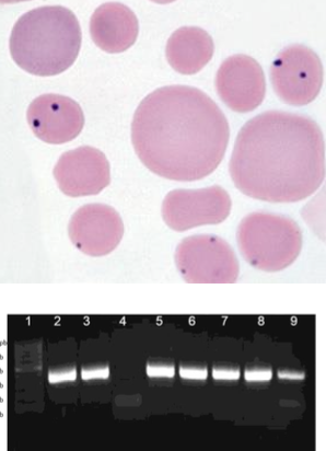 <p>1. blood smear (fresh): dot-like inclusion bodies in RBC margins</p><p>2. PCR</p><p>3. PCR to identify chronic carriers (cELISA)</p>