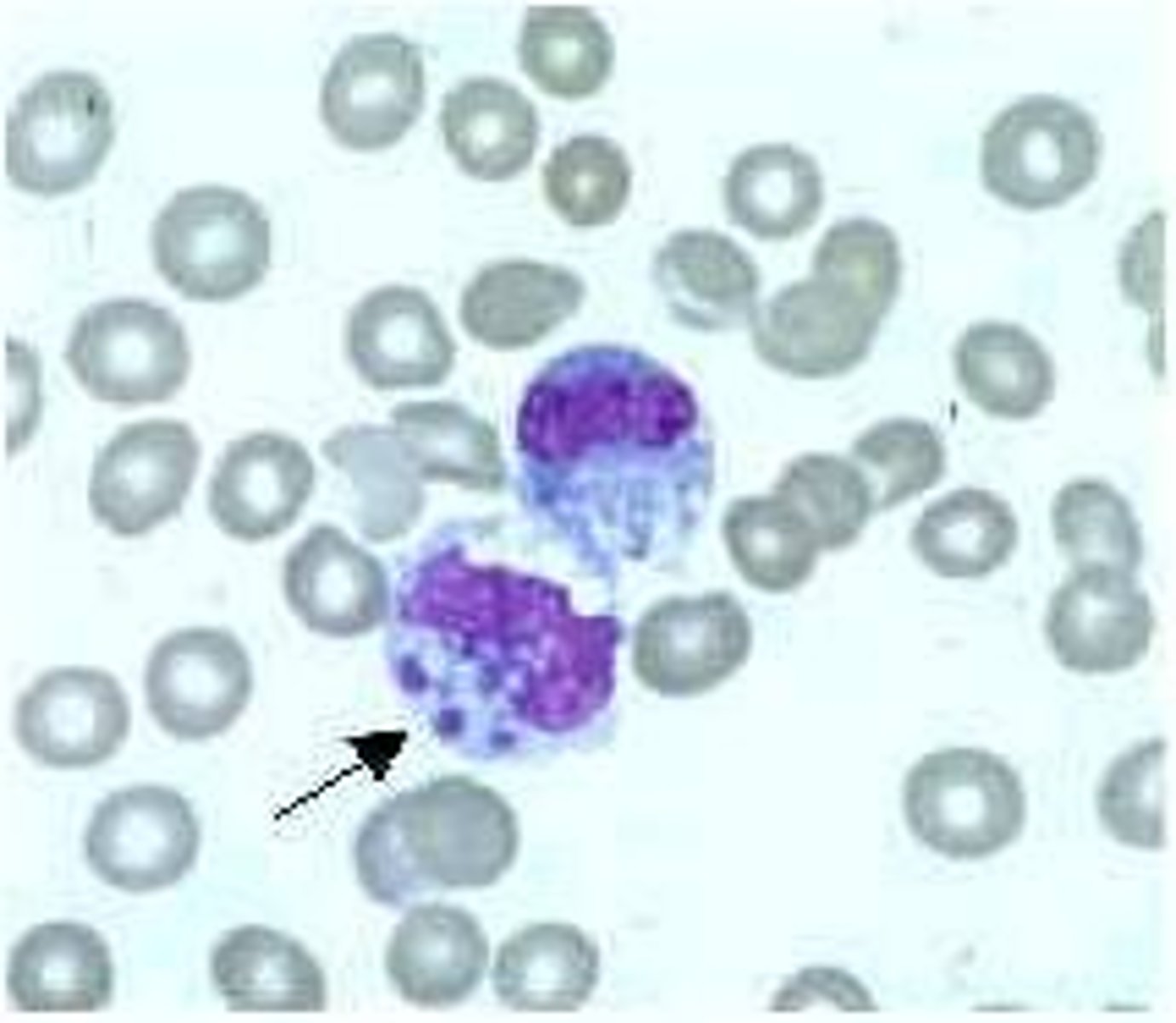 <p>Pathogen: Ehrlichia bacteria</p><p>S+S: Infected leukocytes --&gt; fever, headache, nausea, vomiting, loss of appetite, abdominal pain, myalgia, rash</p><p>Reservoirs: Dogs, deer, rodents</p><p>Transmission: Lone star tick bite</p>