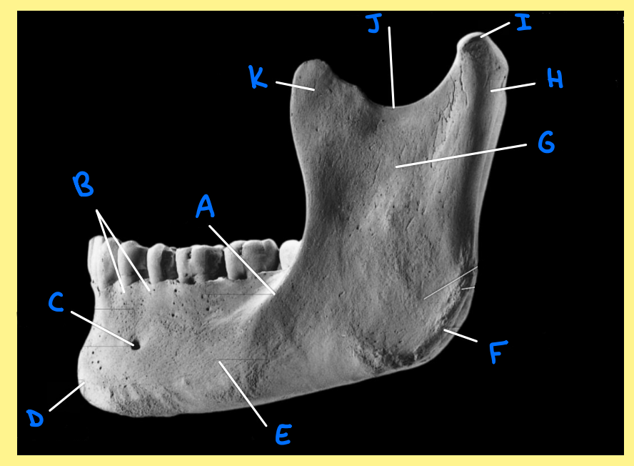 <p><u>Name the following</u>:</p><ul><li><p>Bone?</p></li><li><p>Side?</p></li><li><p>View?</p></li><li><p>F?</p></li></ul><p></p>