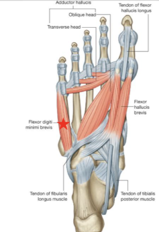 <p>flexor digiti minimi brevis </p>