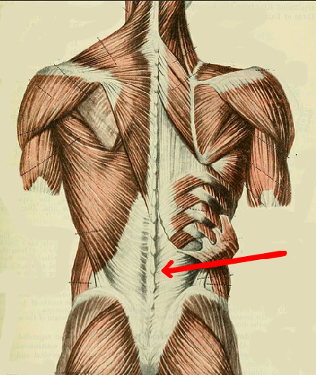 <p>Identify this connective tissue structure.</p>
