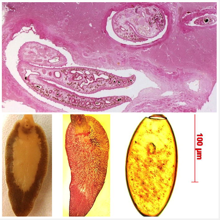 <p>LIVER Your sheep have weight loss, anaemia, jaundice, reduced appetite, weakness and ascites after 3-4 months on a pasture in a flooded area. They have hyperplastic cholangitis, fibrosis and cirrhosis in the liver.</p><ul><li><p>Ingestion of metacercaria with water or pasture</p></li><li><p>Juveniles burrow through liver parenchyma</p></li><li><p>Adults living in bile ducts</p></li><li><p>Treat juveniles with triclabendazole</p></li></ul>