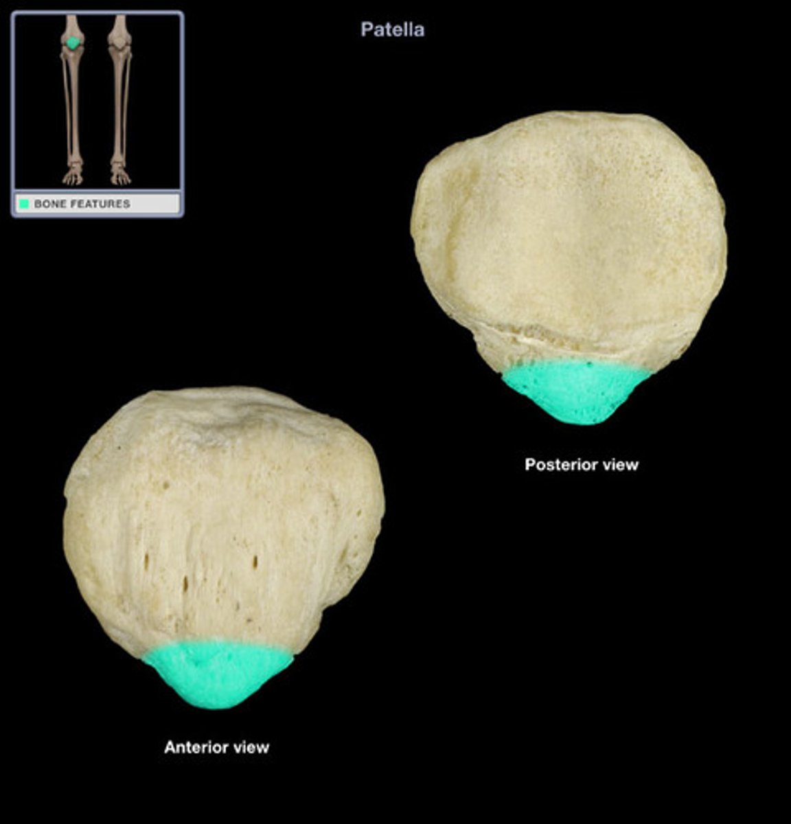 <p>inferior surface for patellar ligament</p>