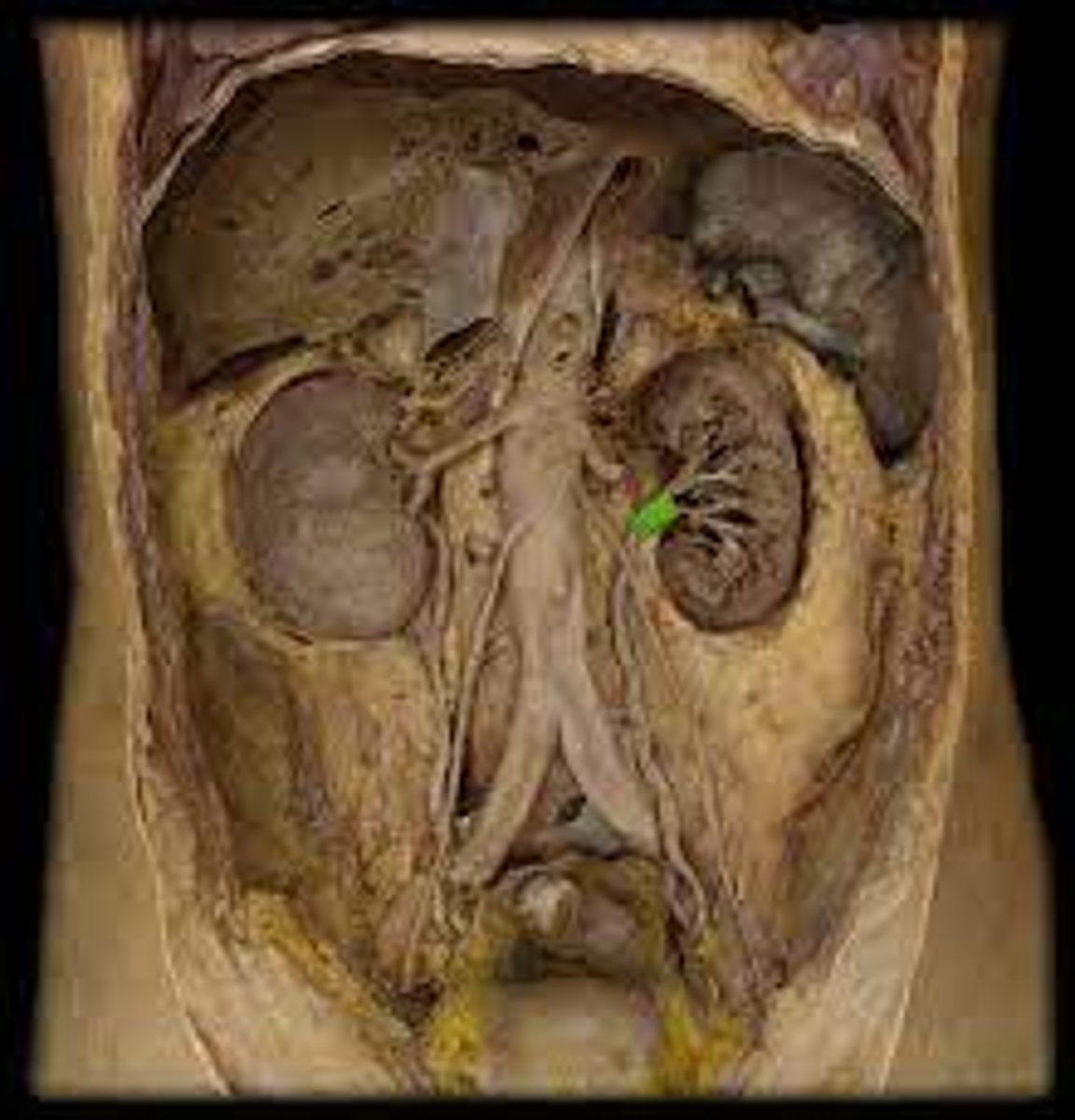 <p>-duct leading from the kidney to the urinary bladder</p><p>-off of left kidney on table 5</p>
