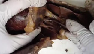 <p>thick, muscular tube in between liver and lungs</p>