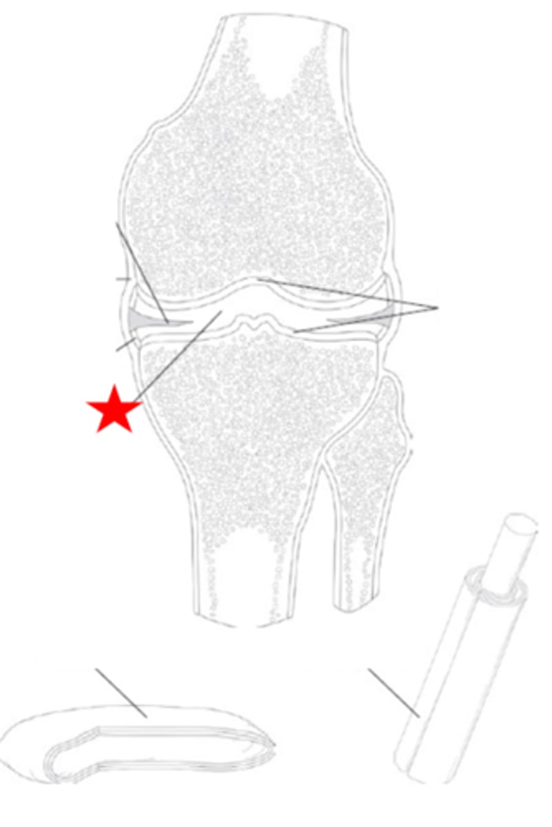 <p>Identify the synovial joint structure that the star is pointing to.</p>