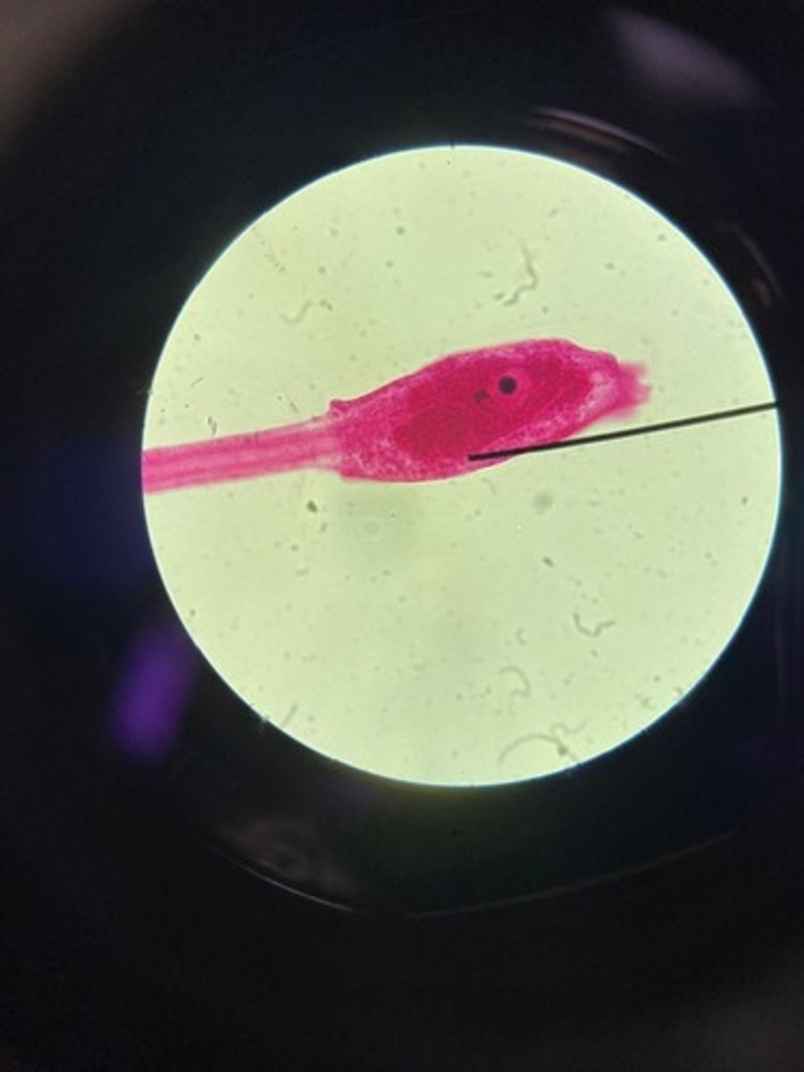 <p>What is the common name of this organism?</p>