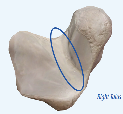 <p>A groove that accommodates a nerve, blood vessel, or tendon.</p>