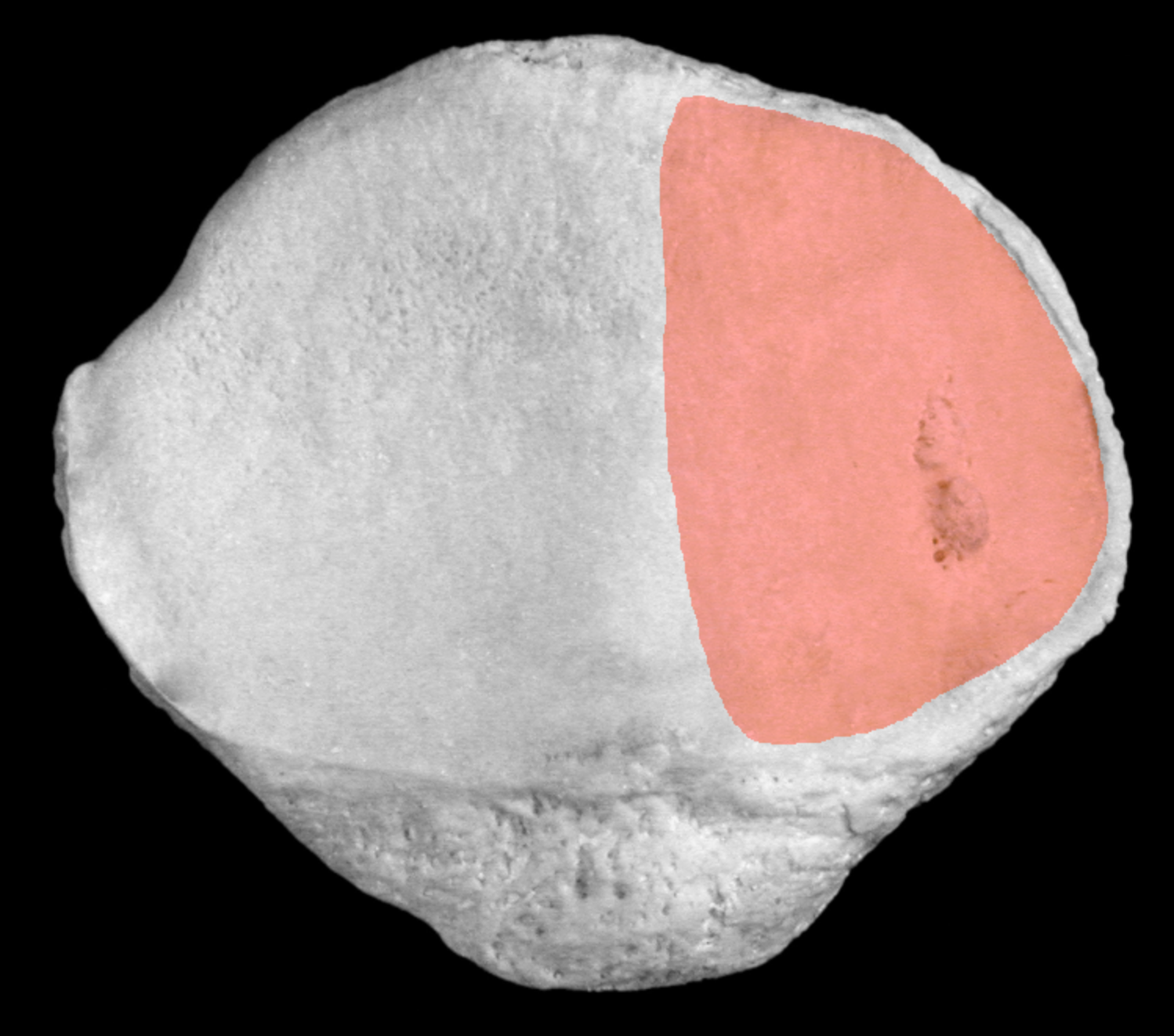 <p>smaller oval on posterior patella</p>