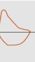 <p>what is this flow volume loop showing </p>