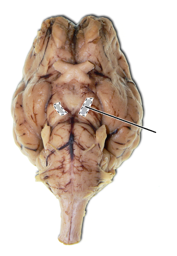 <p>Name the part of the brain that is highlighted.</p>