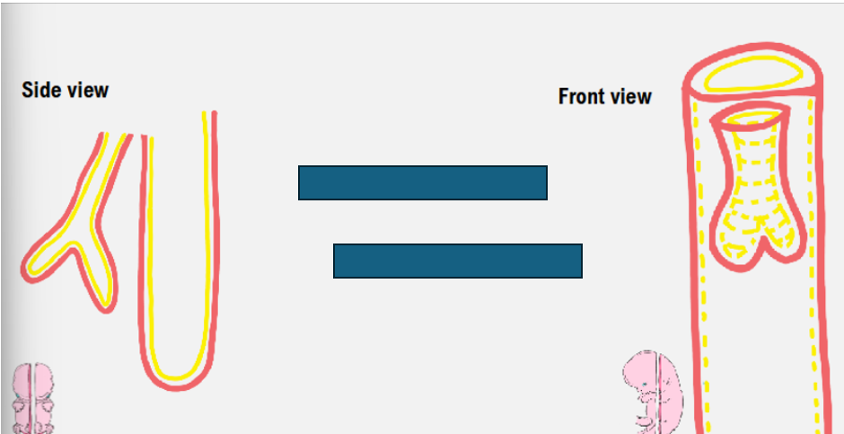 <p>growth of lung bud- week 5</p>