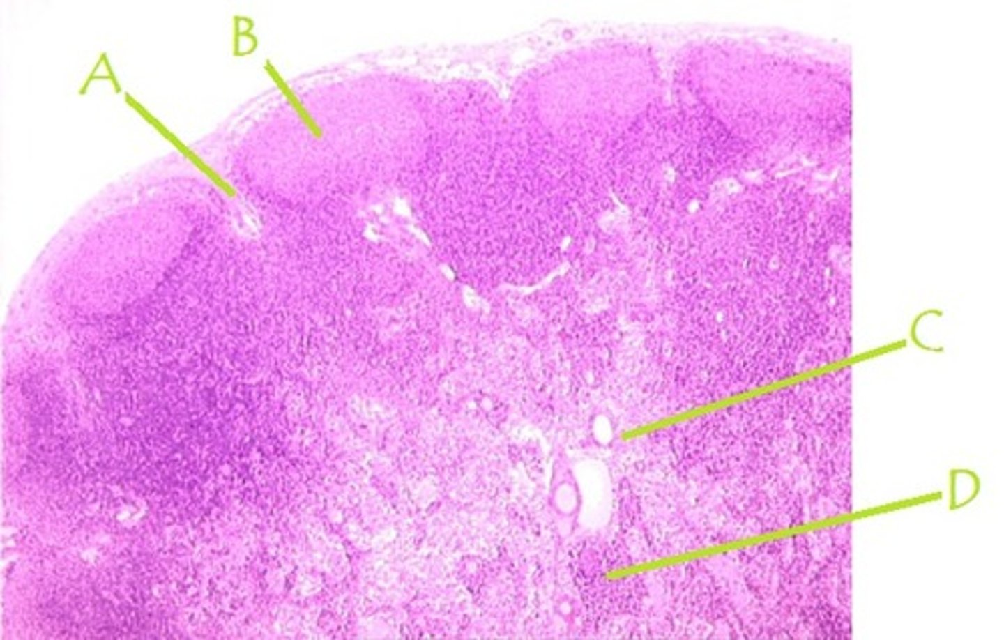<p>Identify A</p>