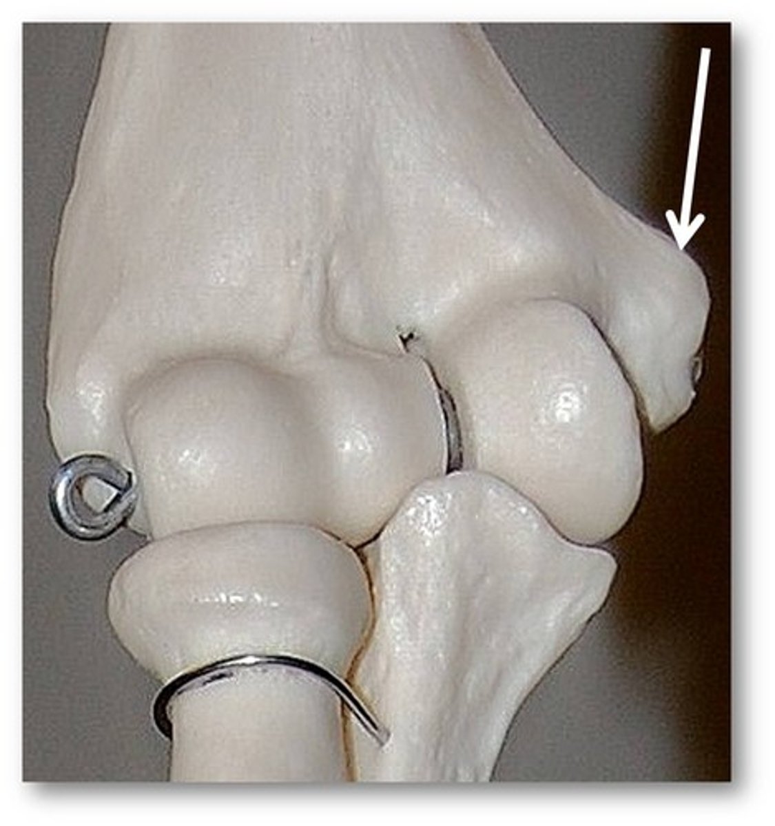 <p>Name this specific part of the humerus.</p>