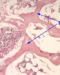 <p><em>Spongy and cancellous</em></p><p>PART OF THE BONE:</p><p>-provides support</p><p>-provides strength</p><p></p>
