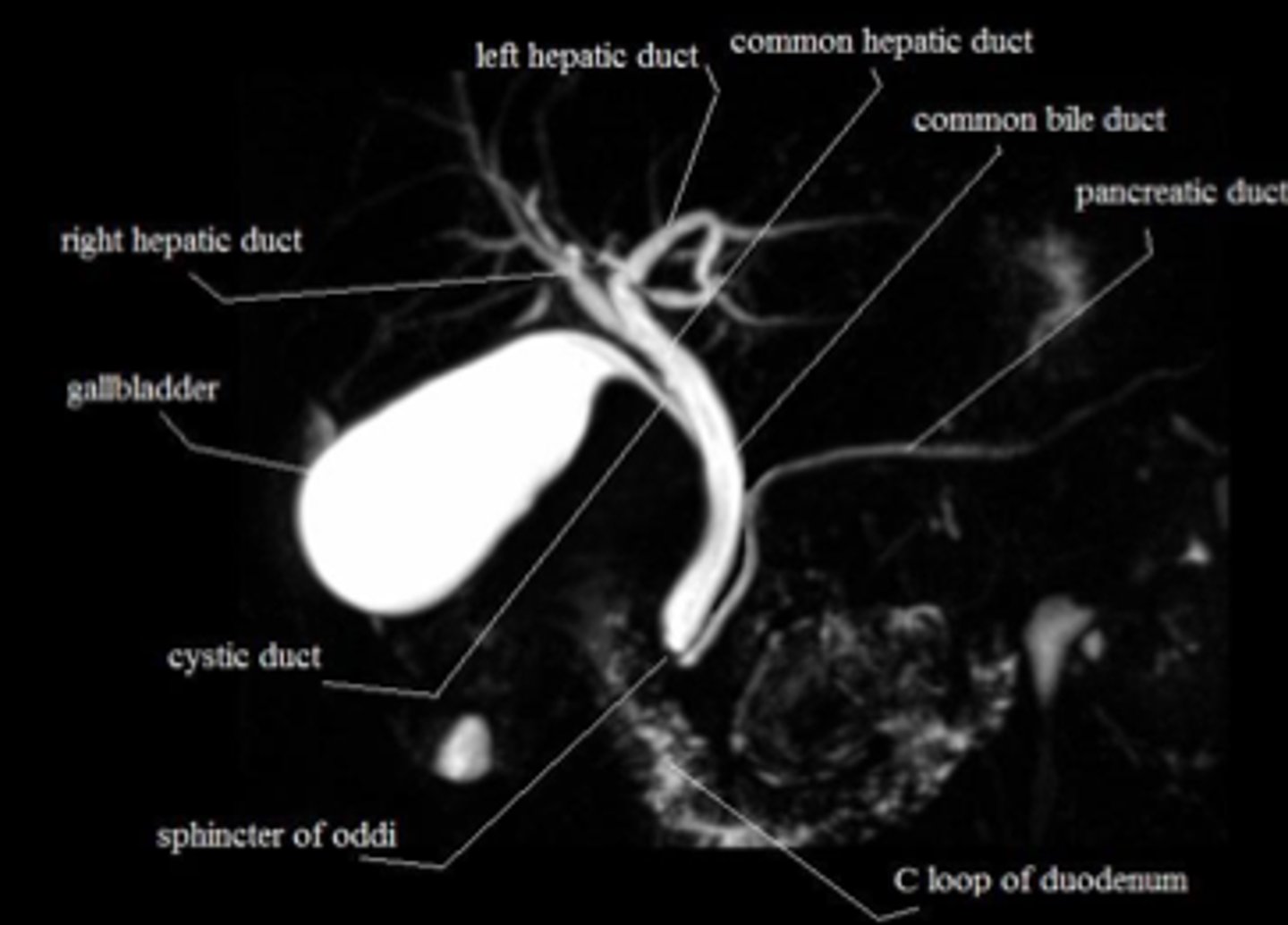<p>non-invasive, useful for imaging the gallbladder, bile ducts and surrounding tissues but does not offer a way to treat the disease found</p><p>US is less expensive and easier test to perform for the diagnosis of cholecystitis</p>