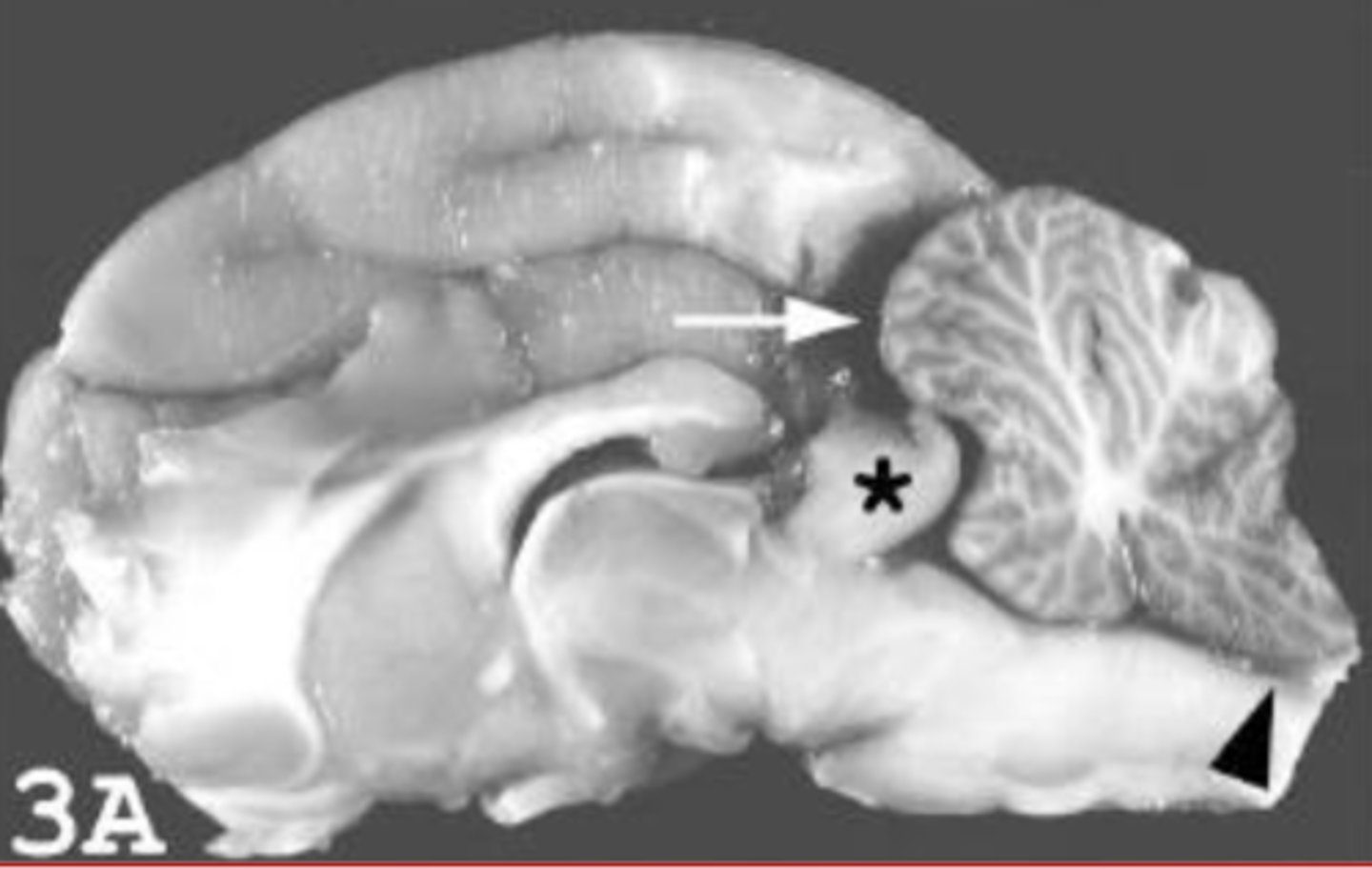 <p>Whats up with this brain? (general issue and thing at the *)</p>